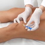 The Science of Knee Gel Injections: How They Work and Why They're Effective