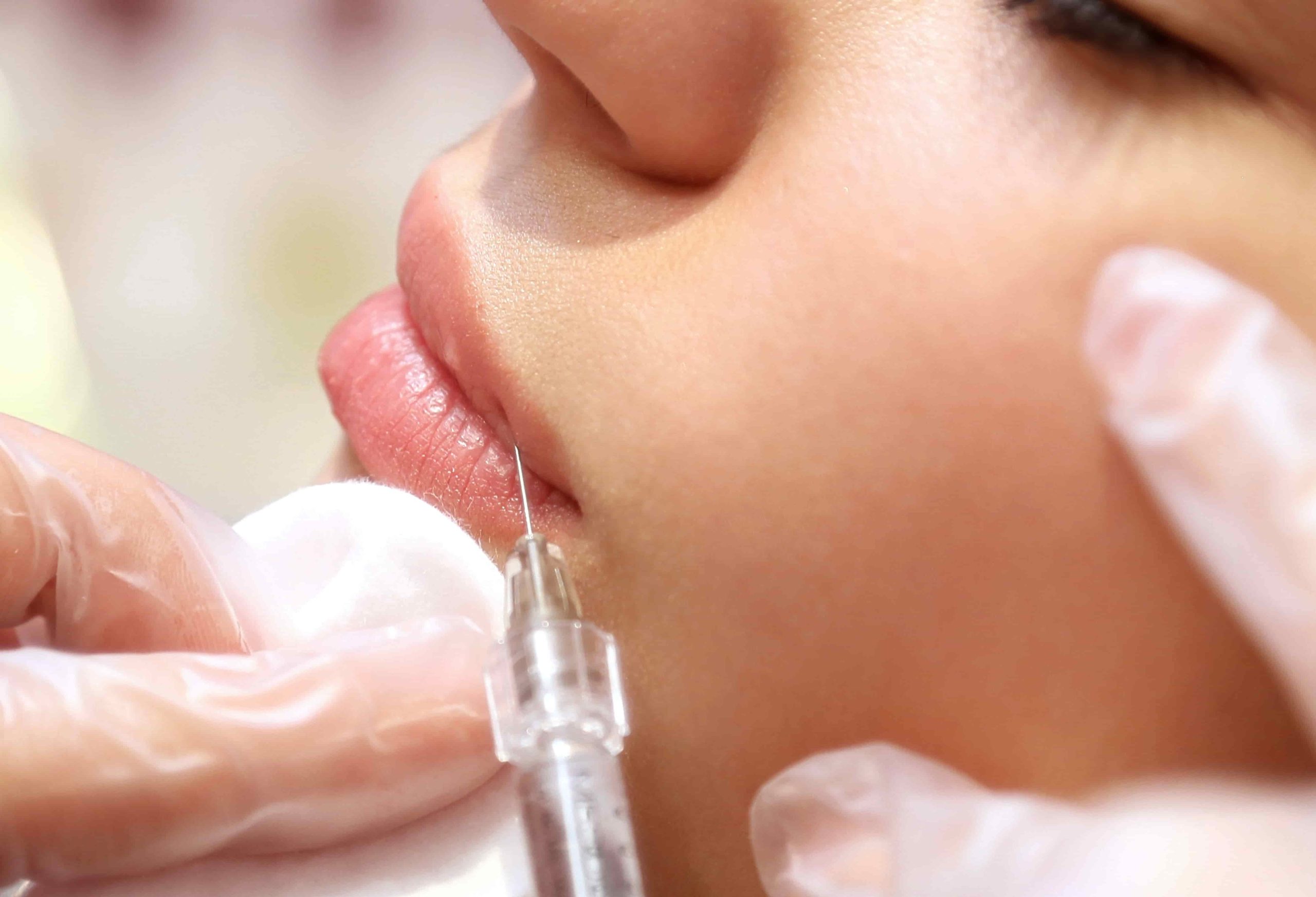 female lips getting injected