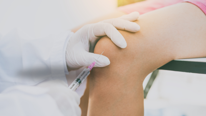Knee injection to treat joint pain caused by osteoarthritis.