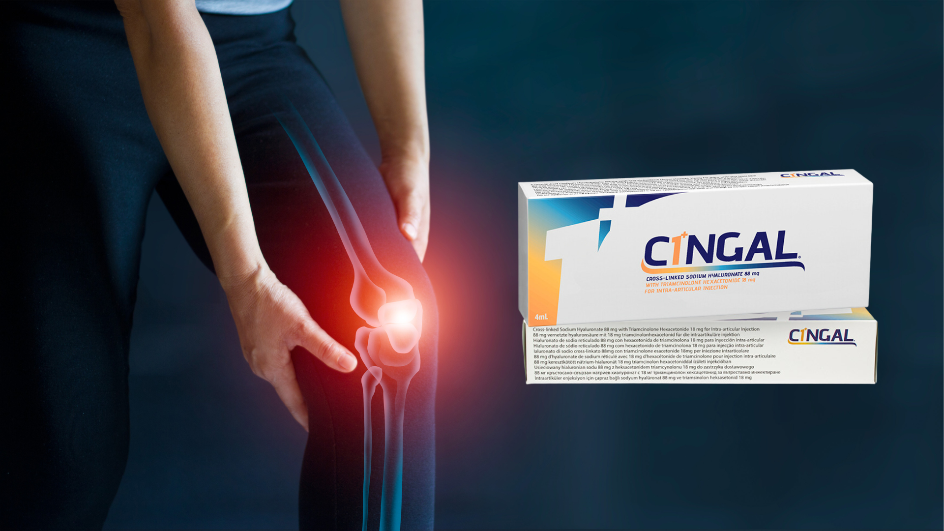 Cingal injections for knee pain caused by osteoarthritis.