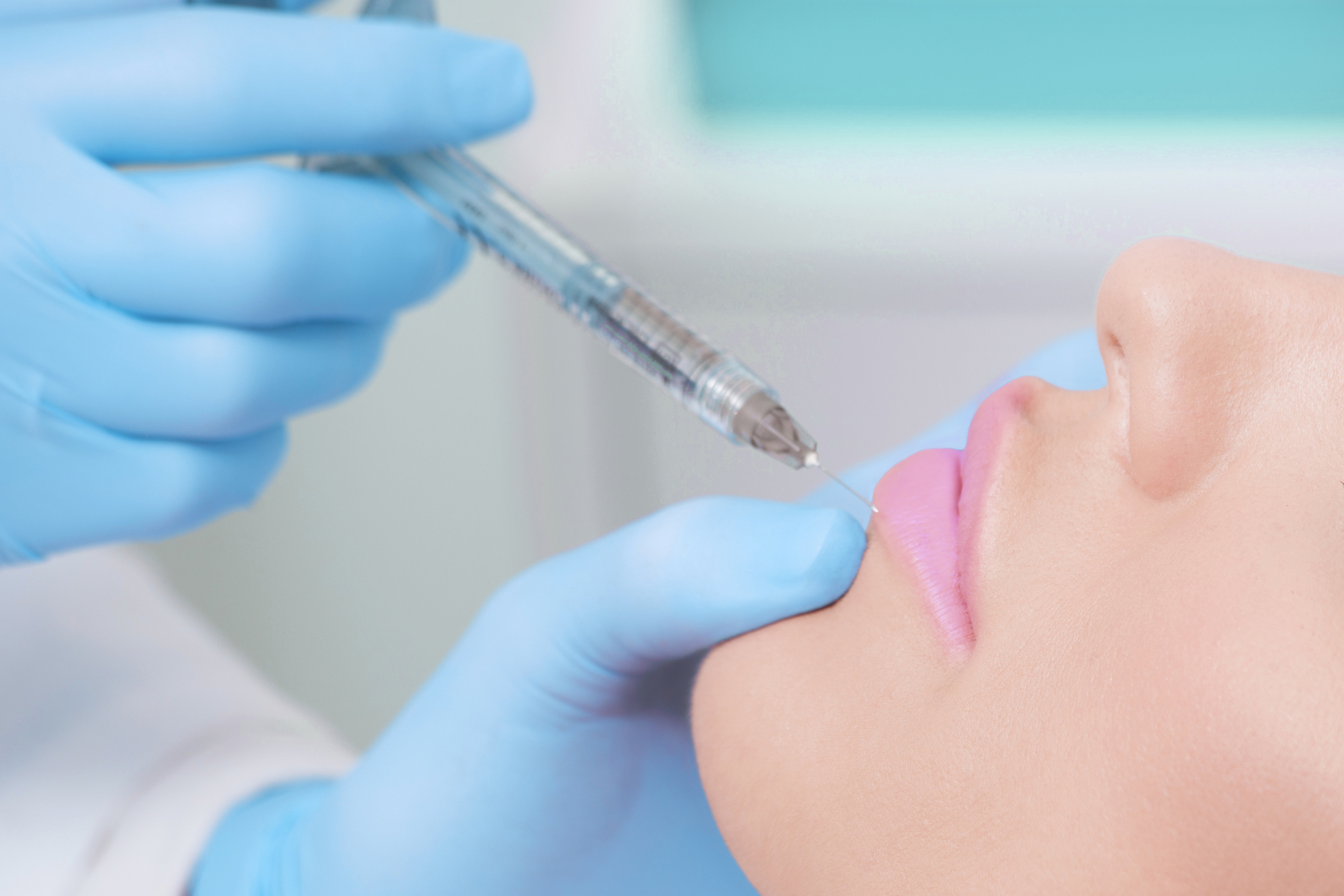 closeup of a female patient getting natural lip filler